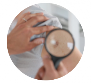 muttermalcheck_2.png