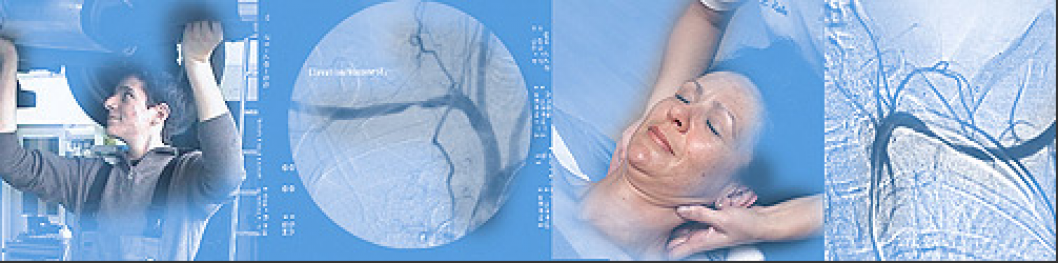 thoracic_outlet.png