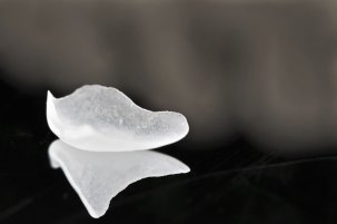 veneers