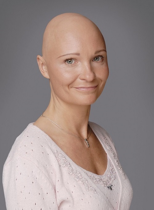BM_Optiderm_Vorher.jpg